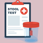 Understanding the Stool Guaiac Test: A Key Tool for Digestive Health
