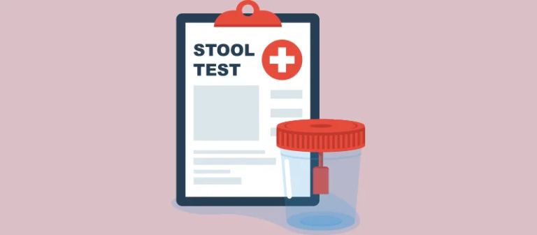Understanding the Stool Guaiac Test: A Key Tool for Digestive Health